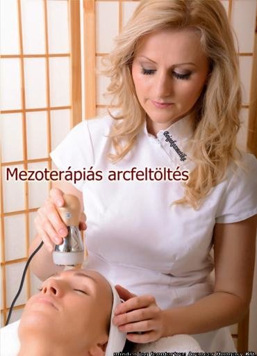 mezoterapia_arcfeltoltes Beigekozmetika